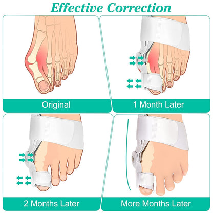 BUNION CORRECTOR FOR TOE SEPARATOR